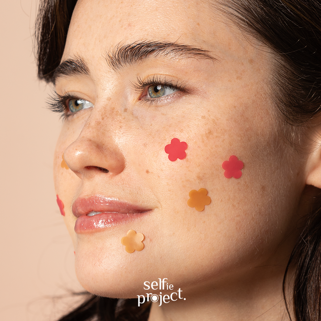 Selfie Project, Stop Spots, Anti-Pimple Flowers, 20 szt